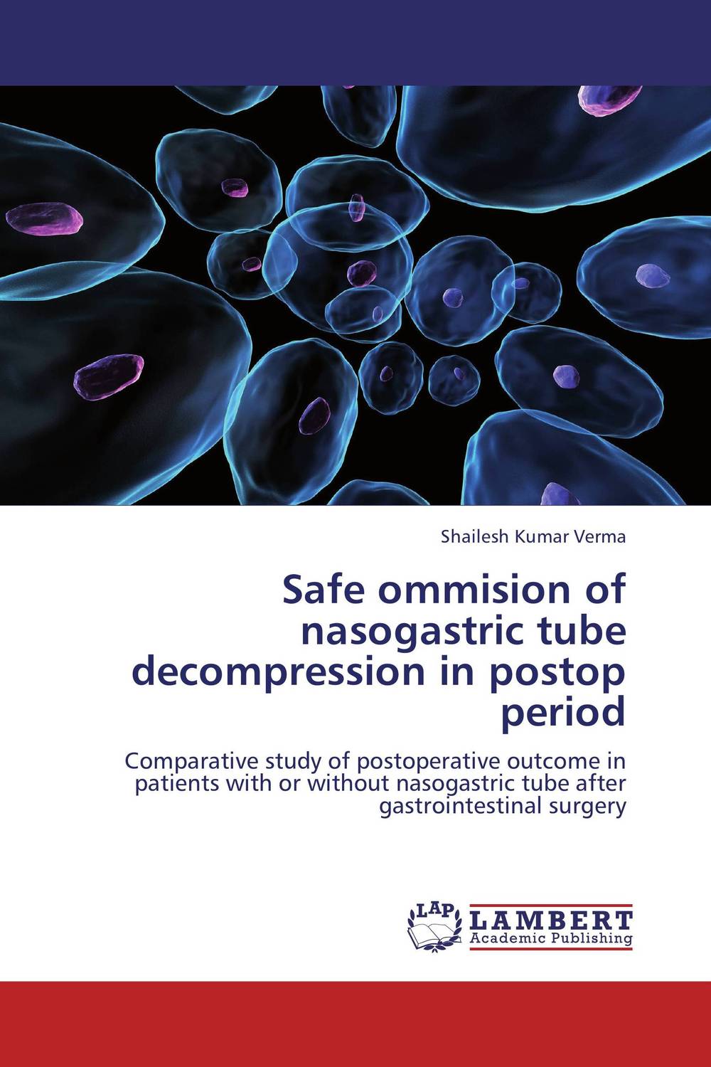 Safe ommision of nasogastric tube decompression in postop period