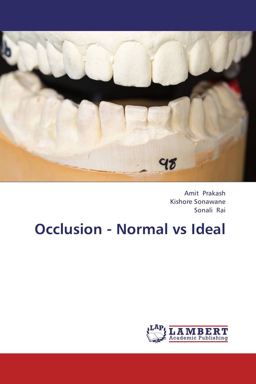 Occlusion - Normal vs Ideal