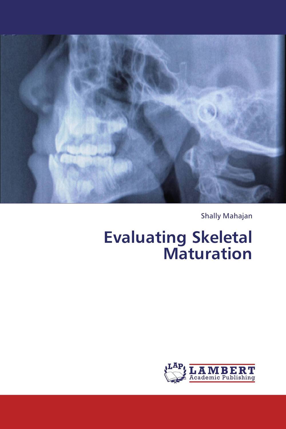 Evaluating Skeletal Maturation