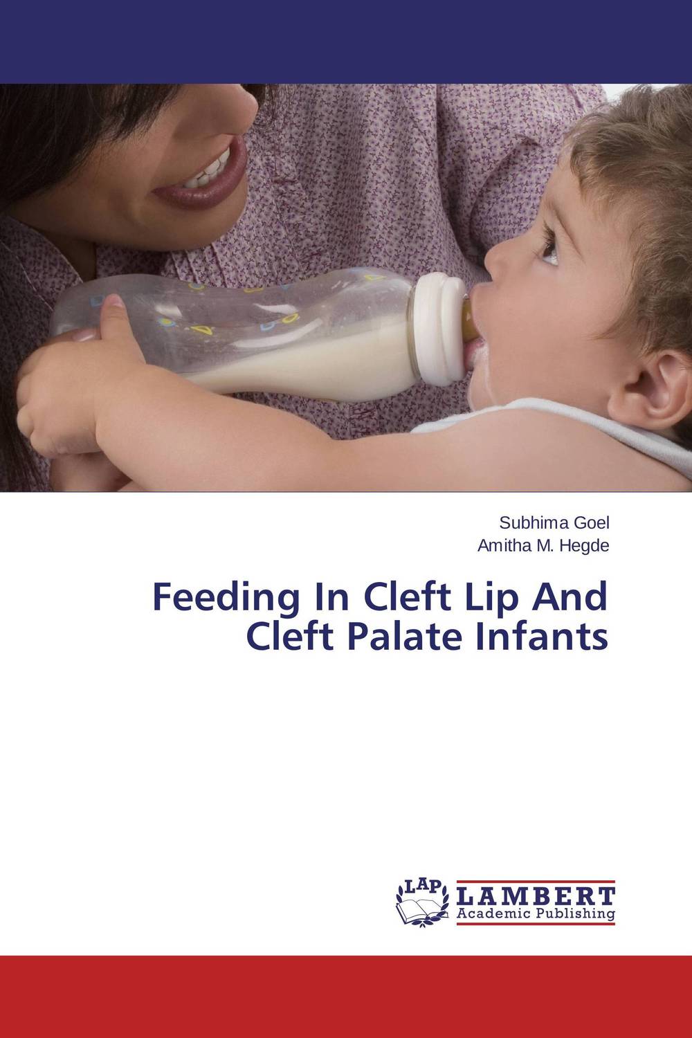 Feeding In Cleft Lip And Cleft Palate Infants