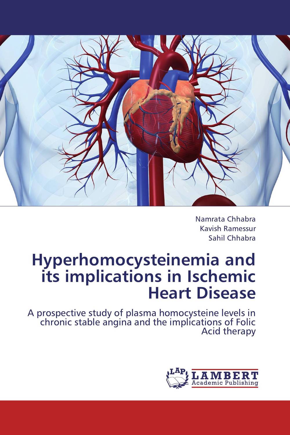 Hyperhomocysteinemia and its implications in Ischemic Heart Disease