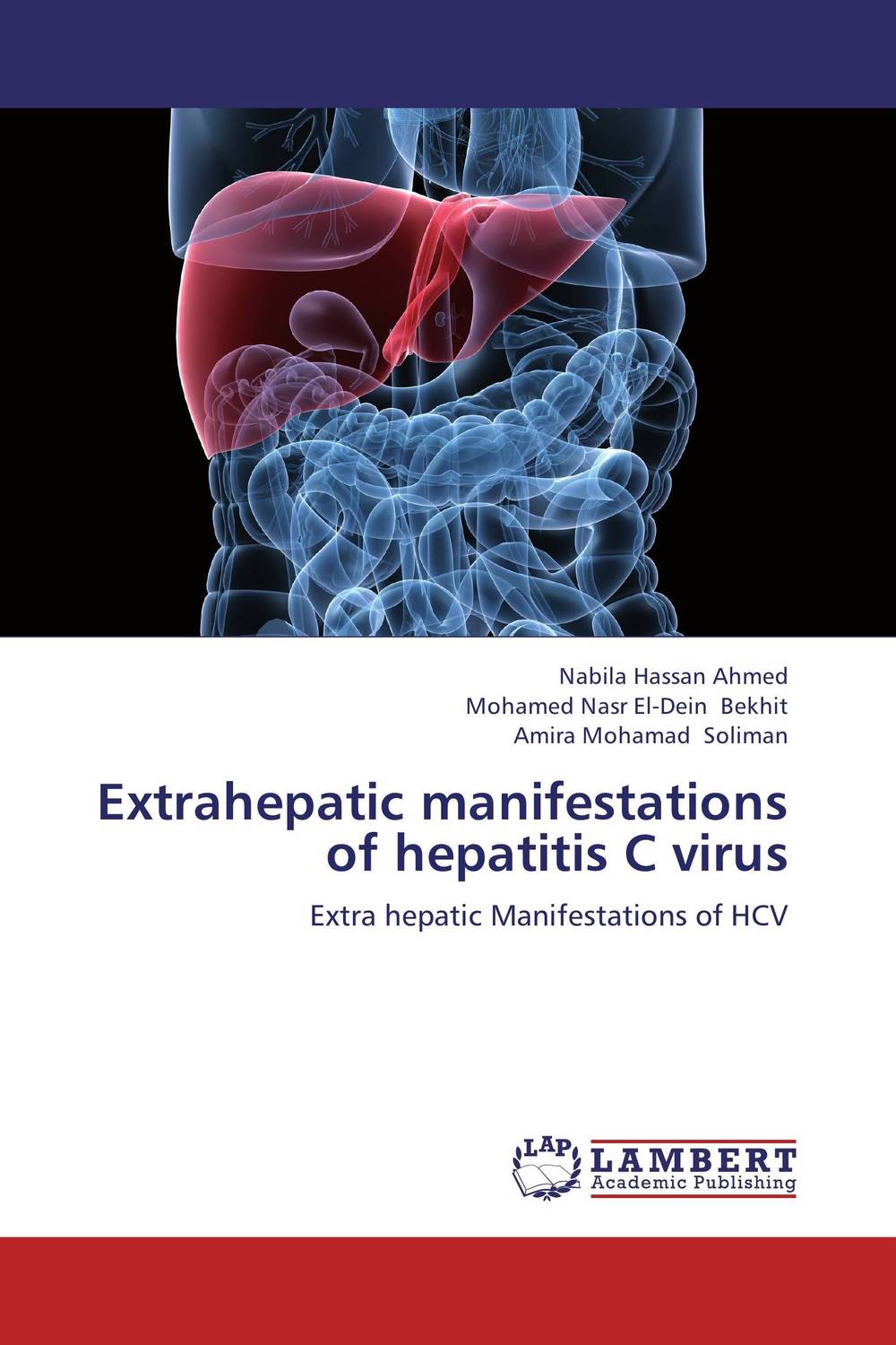Extrahepatic manifestations of hepatitis C virus