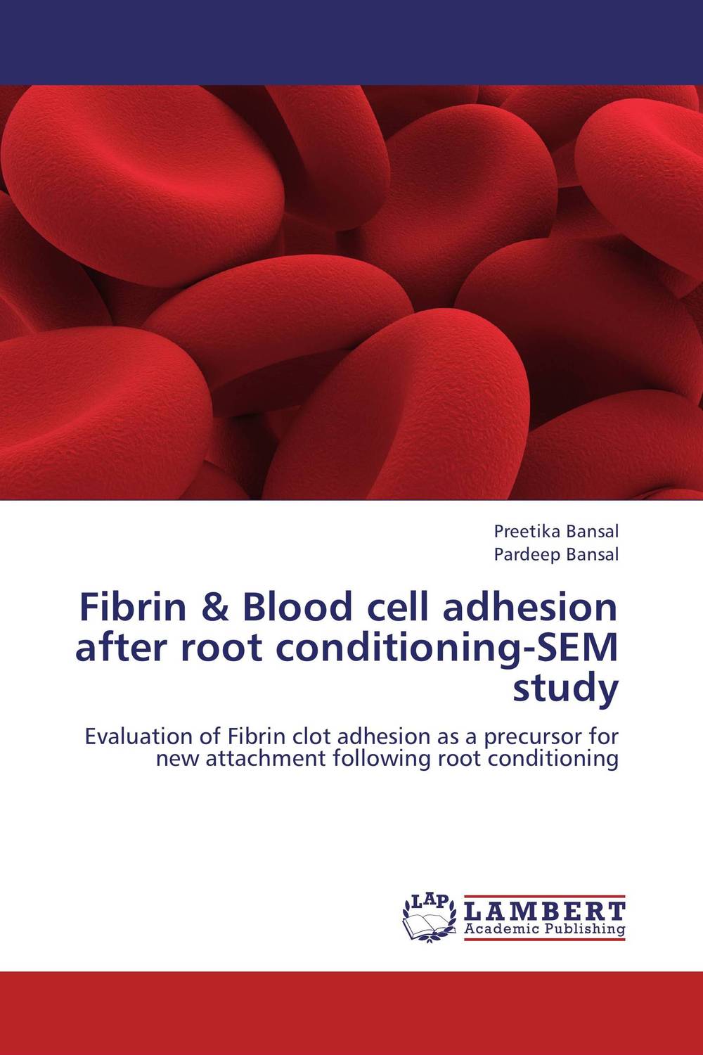 Fibrin & Blood cell adhesion after root conditioning-SEM study