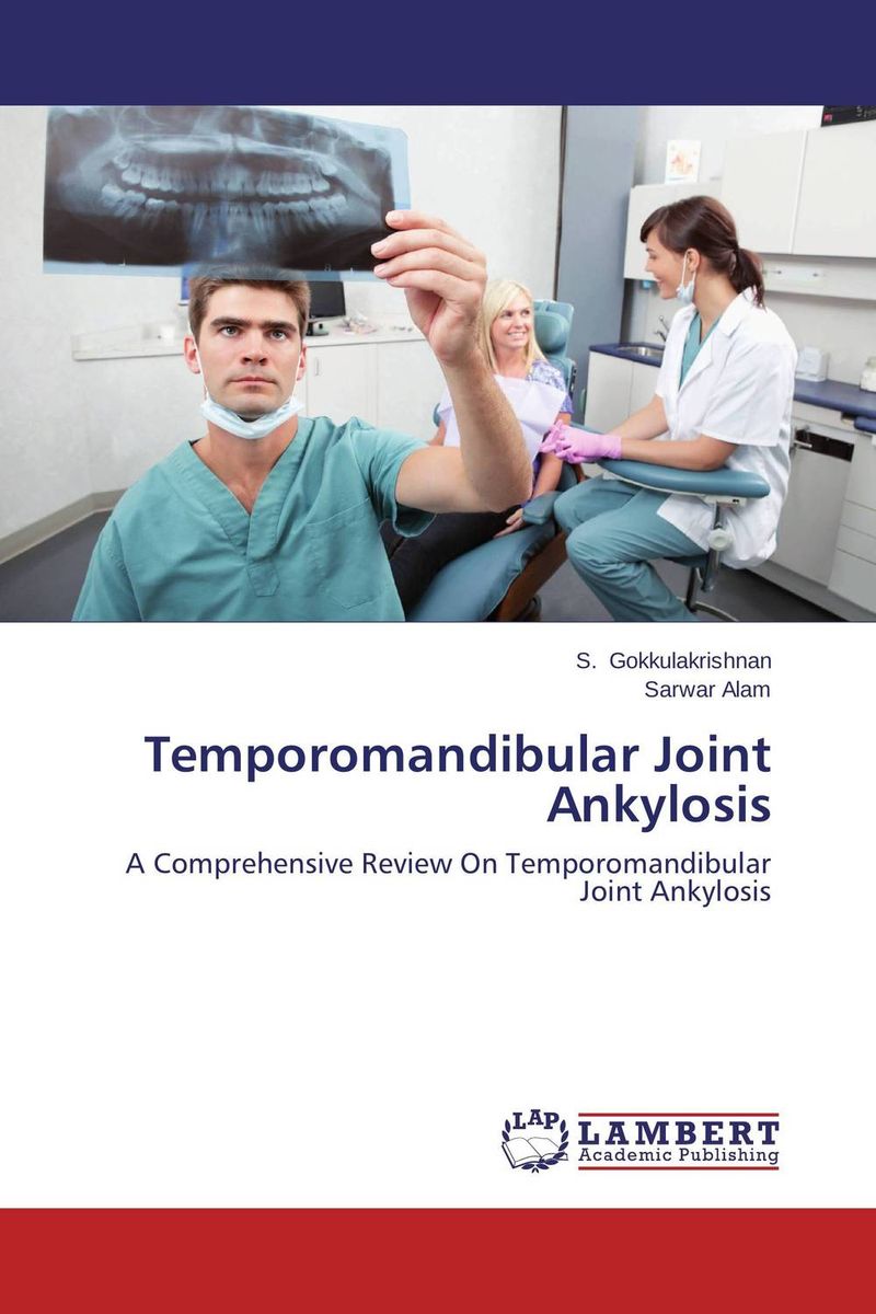 Temporomandibular Joint Ankylosis