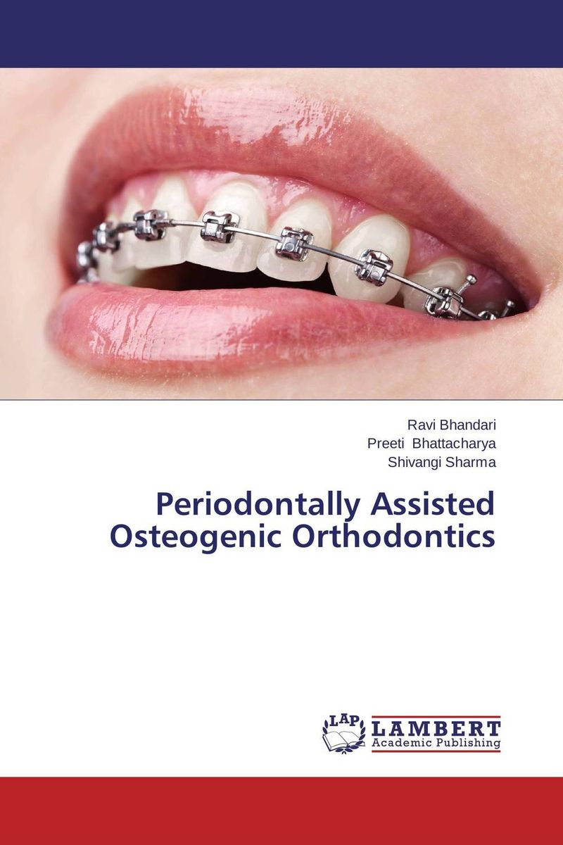 Periodontally Assisted Osteogenic Orthodontics