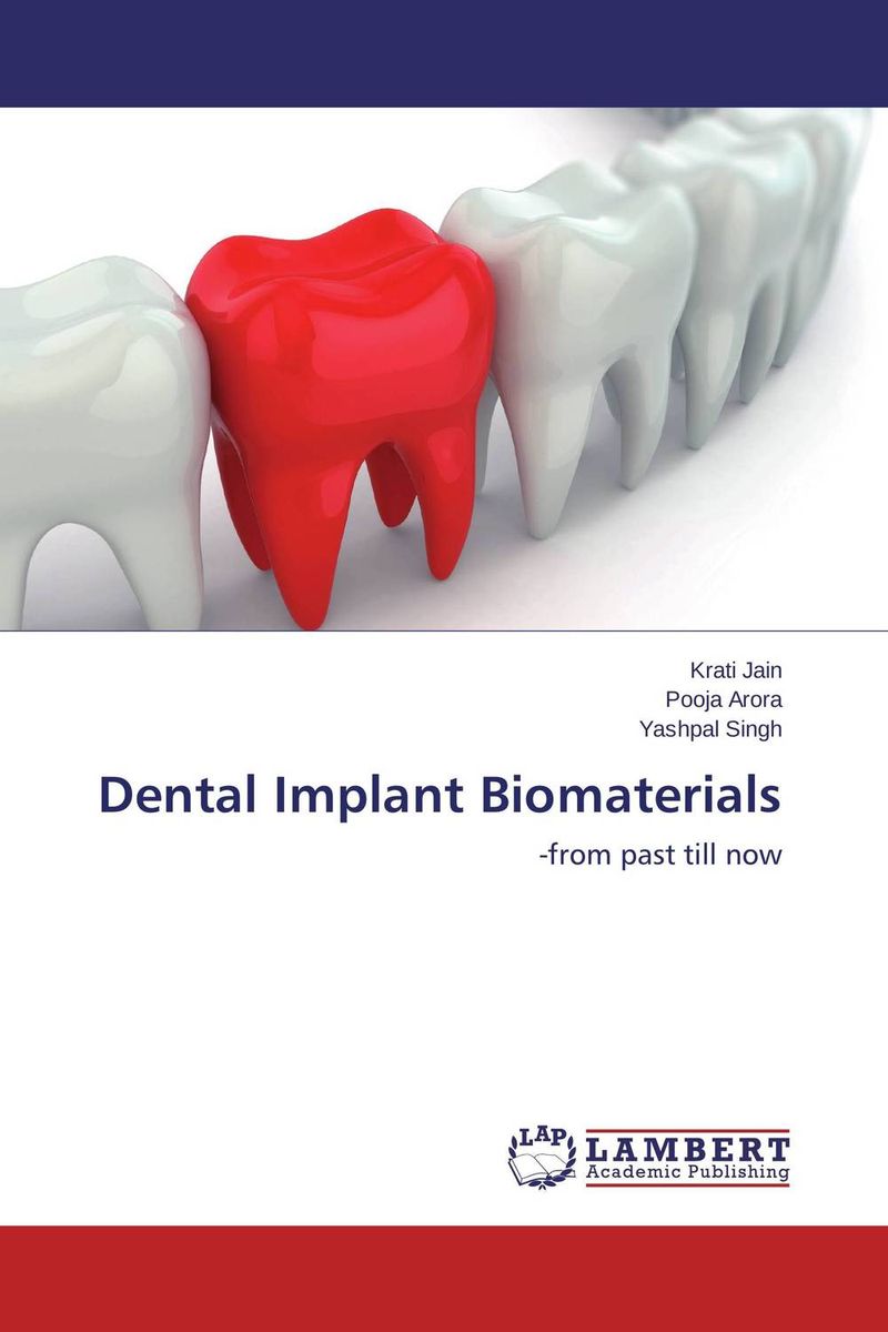 Dental Implant Biomaterials