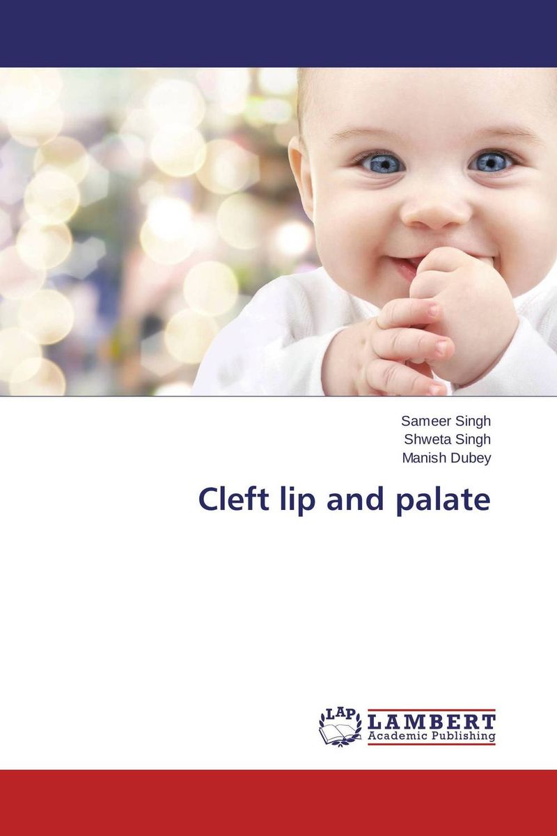 Cleft lip and palate