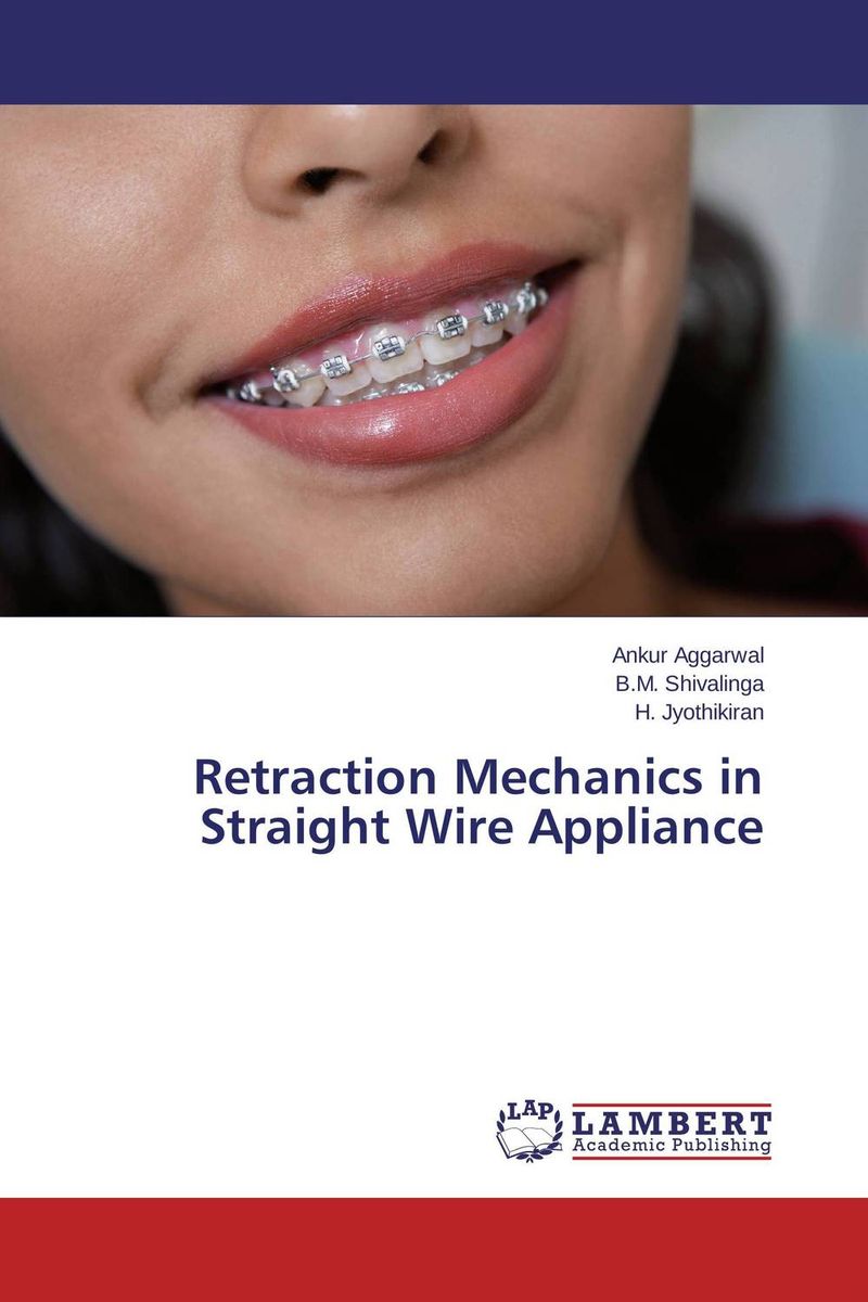 Retraction Mechanics in Straight Wire Appliance