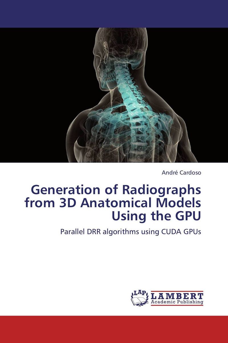 Generation of Radiographs from 3D Anatomical Models Using the GPU12296407 Generation of Radiographs from 3D Anatomical Models Using the GPU12296407This work describes the development of parallel, high performance algorithms for extraction of Digitally Reconstructed Radiographs (DRRs) out of 3D vertebrae models, using the Graphics Processing Unit (GPU). This problem has, inherently, huge amounts of data parallelism, which makes it suitable for acceleration under parallel architectures such as the GPU. The developed algorithms were implemented utilizing the NVIDIA CUDA platform, a parallel computing architecture that enables the programmer to take advantage of the GPU functions. This research is motivated by recent work aiming to attain a process to recover the shape of the spine of human scoliosis patients using two planar radiographs. The former encompasses solving 2D/3D non-rigid image registration problems, involving the creation of DRRs, hundreds of times per second. For this reason, it demands DRR extraction methods with higher throughputs than the ones a CPU can meet.