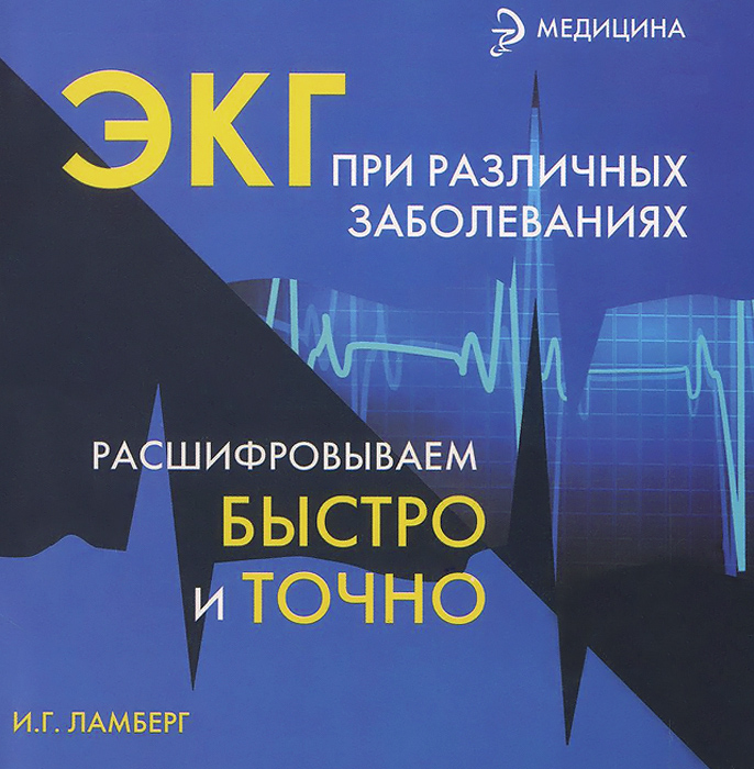 ЭКГ при различных заболеваниях. Расшифровываем быстро и точно