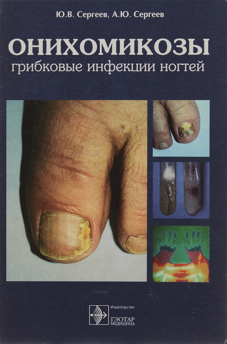 Как лечить палец когда удалили ноготь