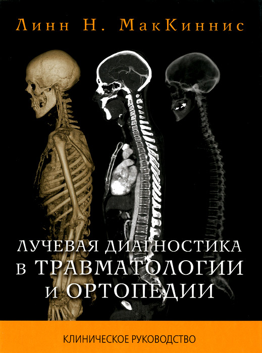 лучевая диагностика учебник word